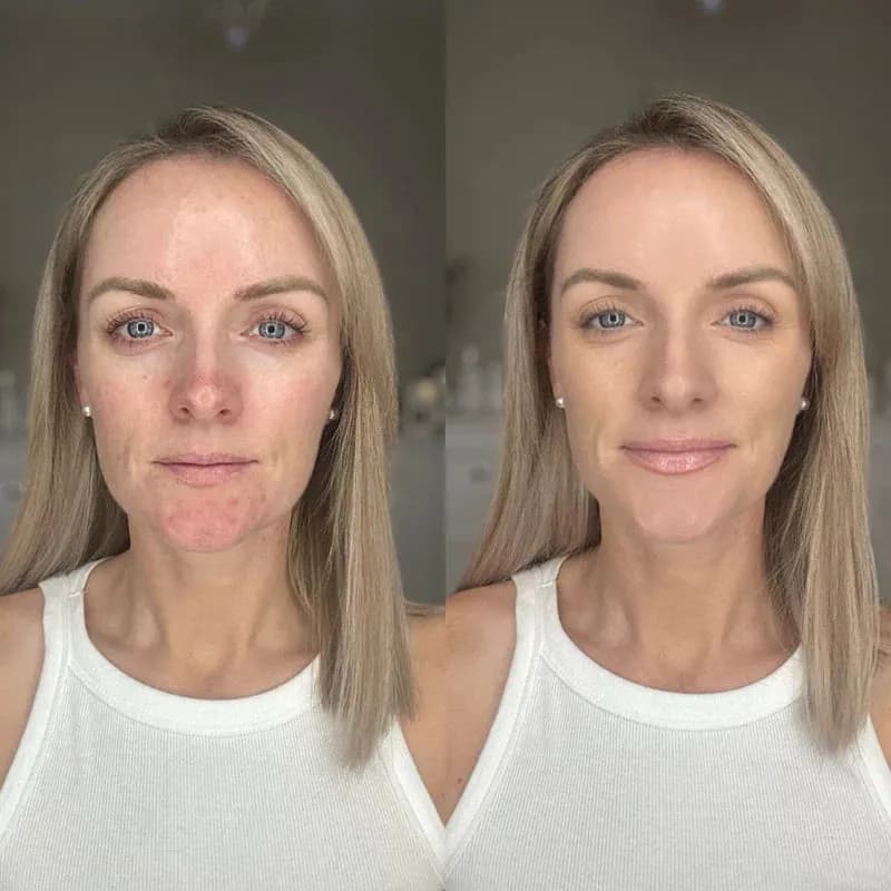 Anti-Redness Colour Corrector with SPF 30 — view 3